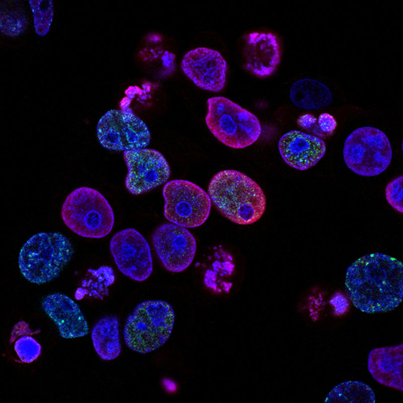κύτταρα σε μικροσκόπιο βοηθούν στην αναζήτηση της θεραπείας για την κατάθλιψη