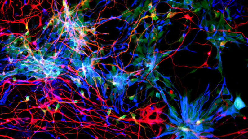 εικόνα από νευρώνες του εγκεφάλου σε λειτουργία