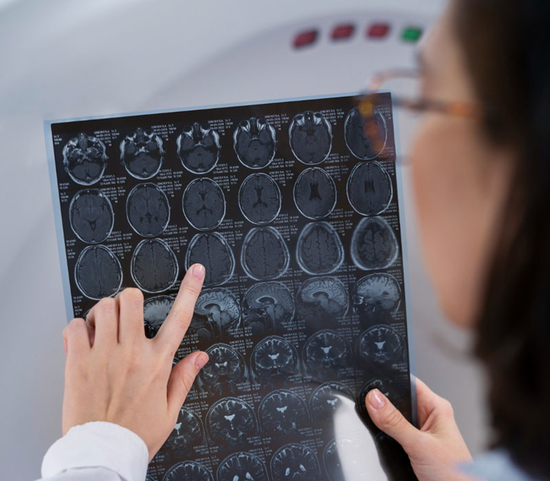 ερευνήτρια κοιτάζει μαγνητική τομογραφία εγκεφάλου