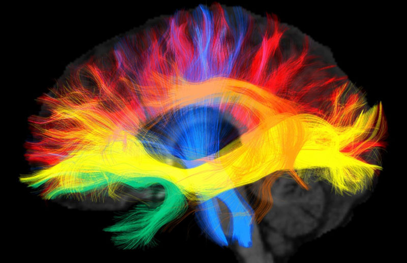 φωτογραφία ανάλυσης της δομής του εγκεφάλου
