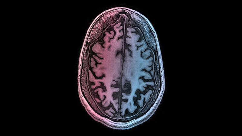 απεικόνιση ενός εγκεφάλου