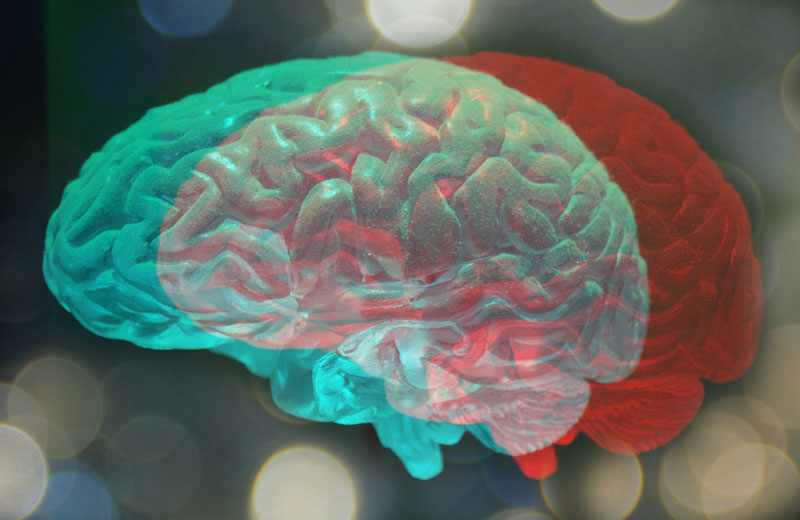 τρισδιάστατη απεικόνιση εγκεφάλου με άνοια στην Ευρώπη 