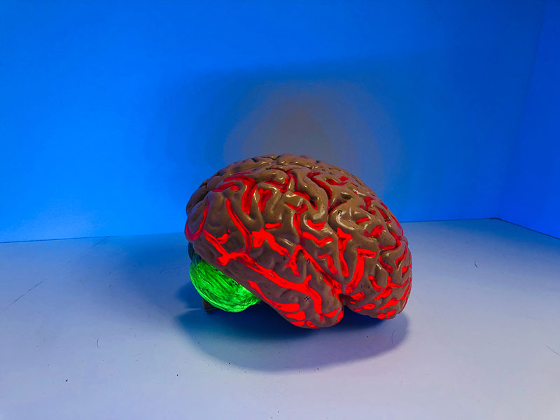 φωτισμένος εγκέφαλος απεικονίζει νέα βήματα από Ελληνες επιστήμονες για πιο εξατομικευμένες θεραπείες στη σχιζοφρένεια