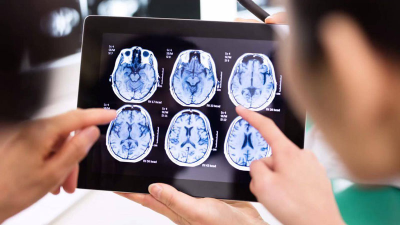 ψυχολόγοι κοιτάζουν μία ακτινογραφία εγκεφάλου αφού έχει σταματήσει η καρδιά