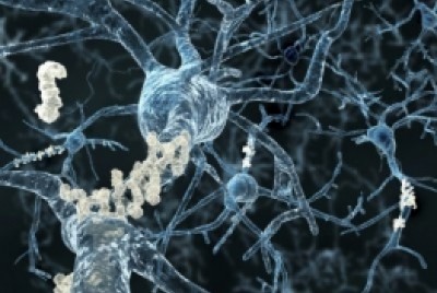 νευρώνες που στέλνουν σήματα γύρω τους