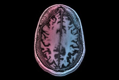 απεικόνιση ενός εγκεφάλου