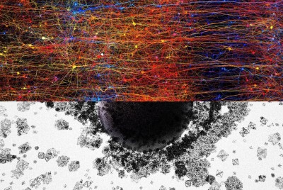 εγκεφαλικοί νευρώνες και δίκτυα