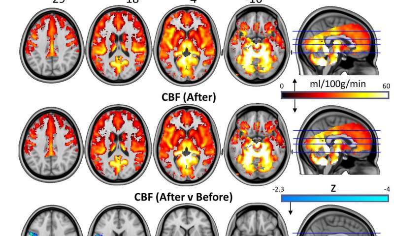 Psilocybin rese