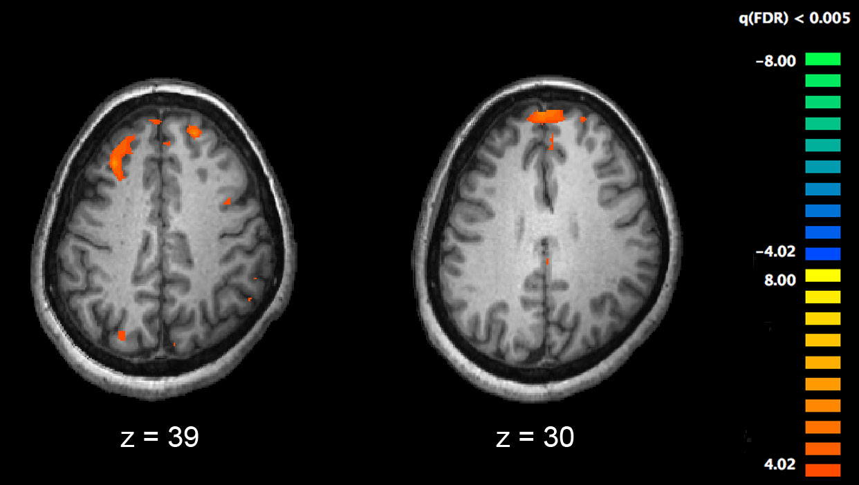 schizbiol1