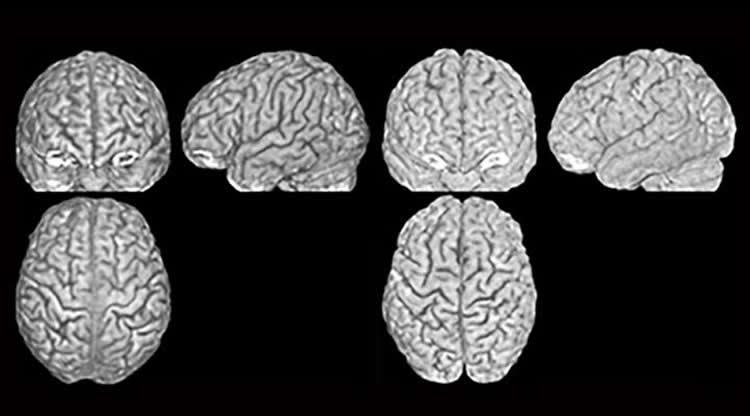 uniquebrainanatomy